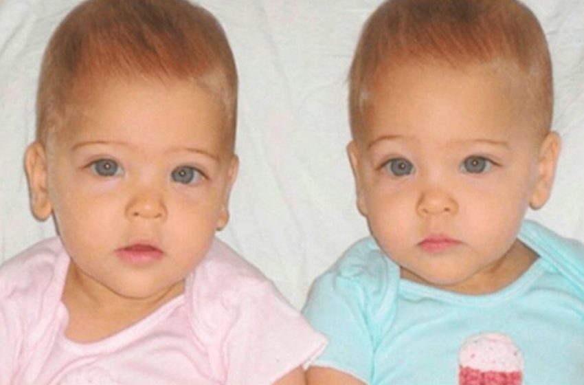 Aún conservan su encanto: Así lucen las gemelas más bellas del mundo en su edad madura