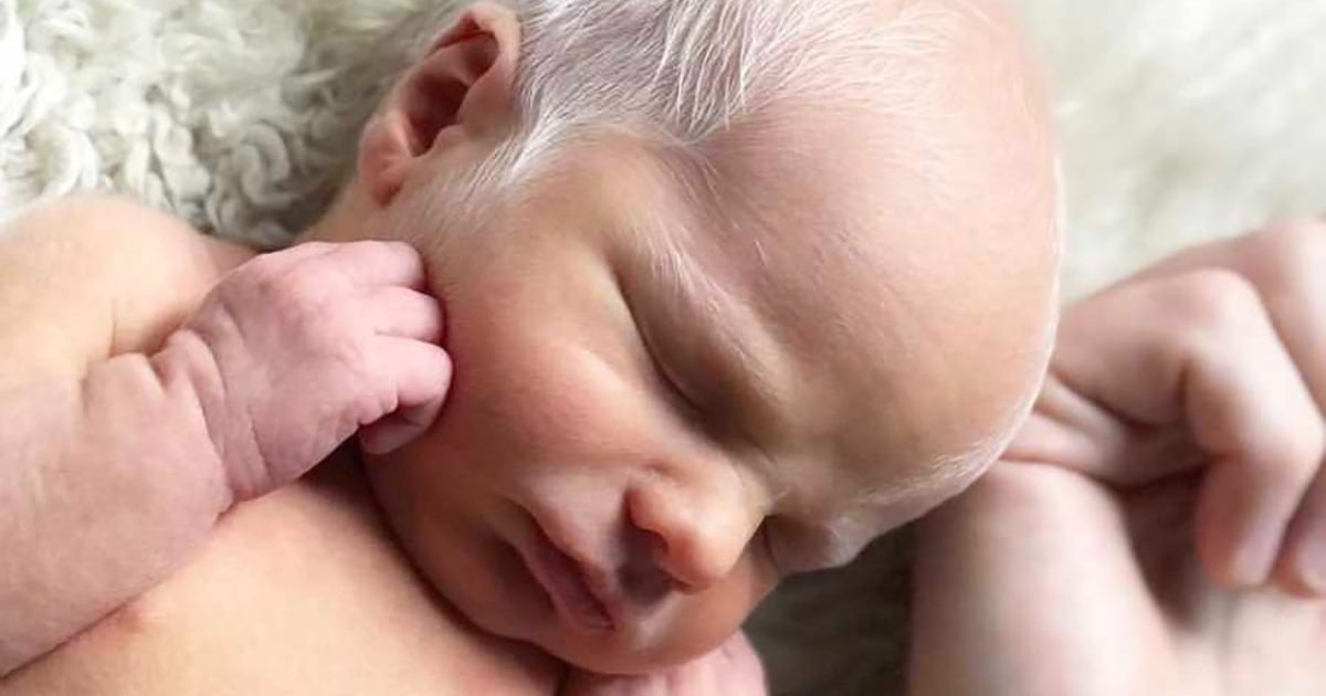 Bebé burlado por tener el pelo blanco: años después, luce perfectamente feliz y saludable