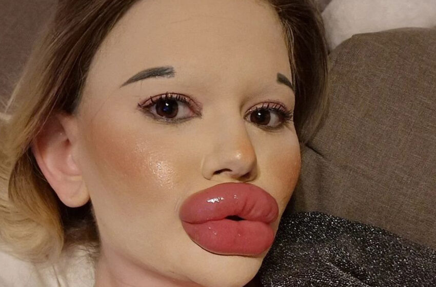 Una mujer búlgara de 25 años se somete a más de 27 procedimientos para tener los labios más grandes del mundo.