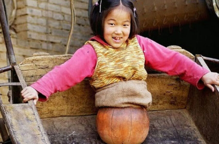  El balón de baloncesto reemplazó sus piernas, y la perseverancia la ayudó a convertirse en Campeona: Cómo vive ahora y qué ha logrado