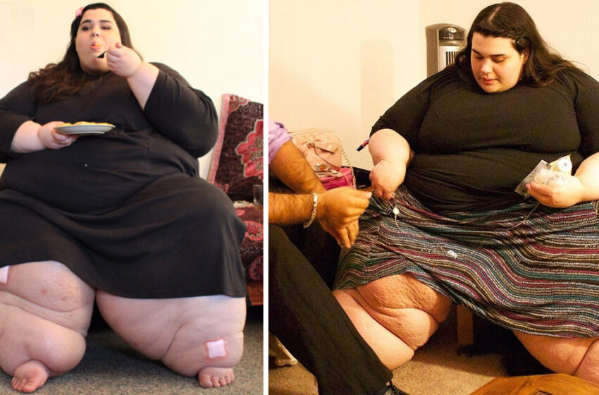  “Pesaba 300 kg a los 28 años”. La chica que perdió 200 kg se transformó en una belleza que el mundo nunca había visto