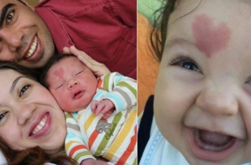 Un bebé nacido con una marca de nacimiento en forma de corazón en su frente: ¿Cómo luce ahora?