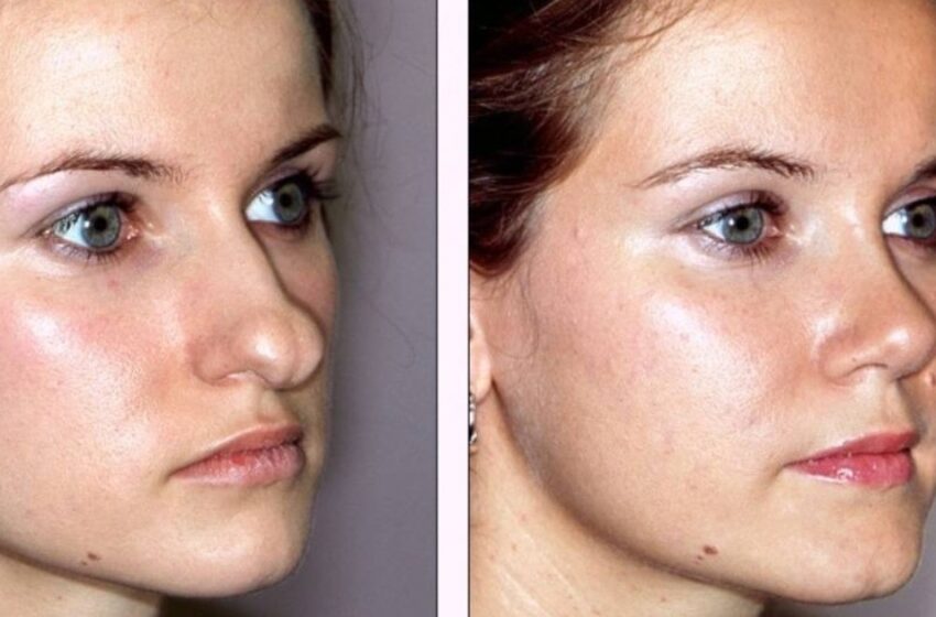 Lado Positivo de la Cirugía Plástica: ¡Fotos de Chicas que se Sometieron a Cirugía Plástica para Mejorar su Apariencia!