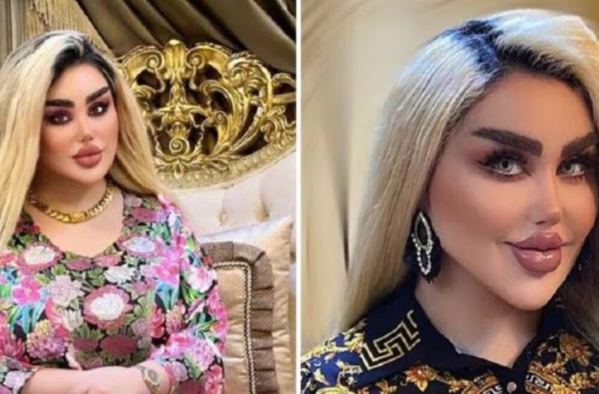 “Expectativa vs Realidad”: La chica se sometió a 43 intervenciones cosméticas para parecerse a Barbie, ¡pero en realidad parece un “monstruo”!