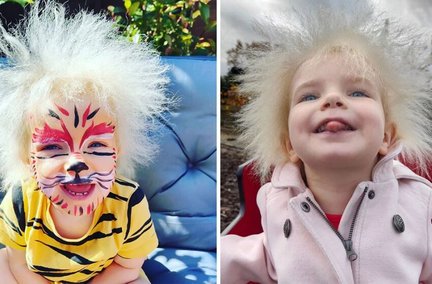  Las lindas fotos de la niña se han propagado por toda la red: ¿Cómo luce una pequeña niña británica con el síndrome del cabello inmanejable?