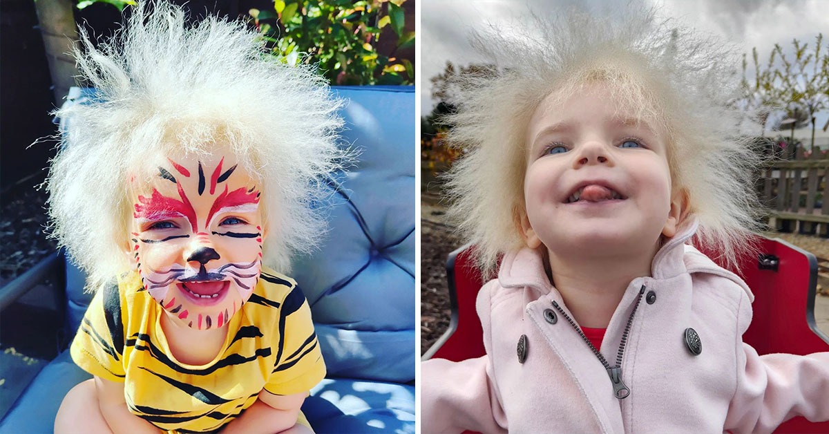 Las lindas fotos de la niña se han propagado por toda la red: ¿Cómo luce una pequeña niña británica con el síndrome del cabello inmanejable?