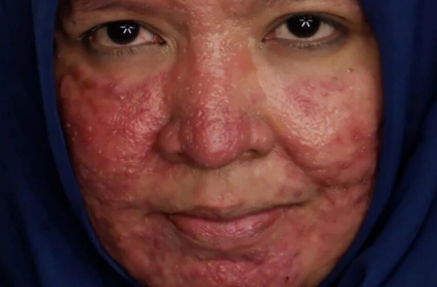 “De una chica con acné en su rostro a una hermosa novia”: ¡Un talentoso maquillador transformó a la chica más allá del reconocimiento!