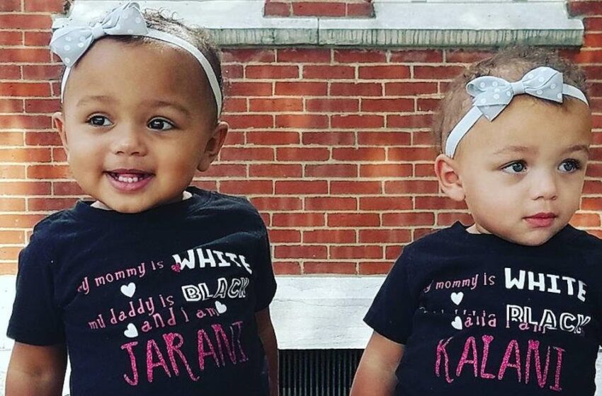  El nacimiento de gemelos con diferentes colores de piel sorprendió a los padres: ¿Cómo lucen los niños ahora, a los 7 años de edad?