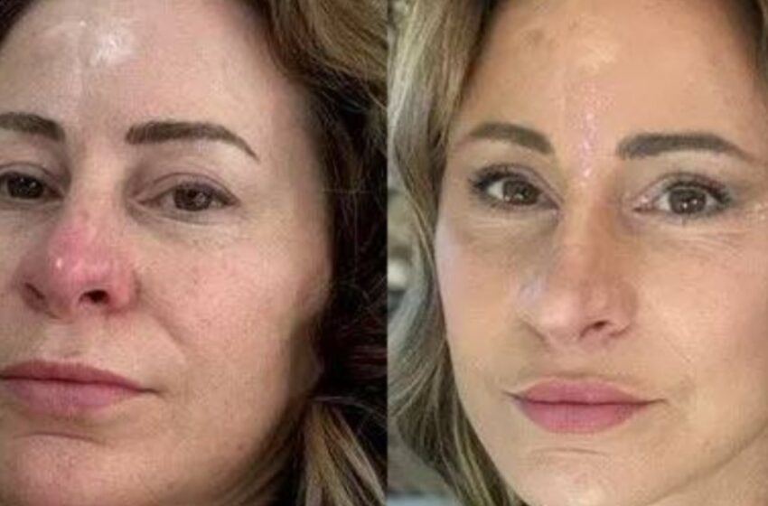 “Una mujer de 50 años vendió su casa por una “nueva cara”: ¿Cómo se ve ahora la mujer sin hogar después de un lifting facial?”