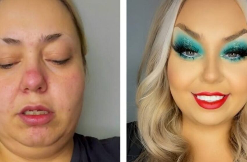 “Hombres, tengan cuidado”: ¡Una chica con dientes dañados y acné en su rostro se transformó en una belleza deslumbrante en cuestión de minutos!