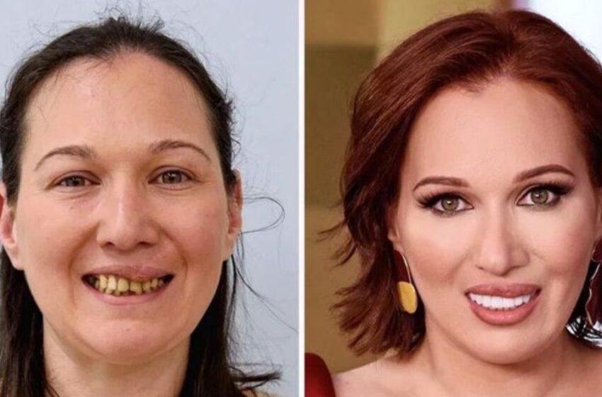 “Dientes rotos y piel descuidada”: ¡Estilistas transformaron a estas amas de casa en verdaderas estrellas de Hollywood!