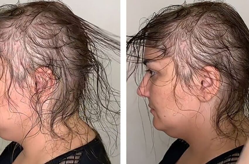 “¡Qué Transformación Tan Asombrosa!”: ¡El Peluquero Logró Crear Un Peinado Chic A Partir De Un Cabello Raro!