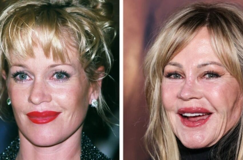  “Cuando las expectativas no se cumplen”: ¡13 impactantes fotos de antes y después de celebridades que se sometieron a cirugías estéticas!