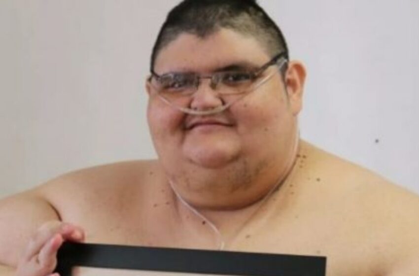 “Él Fue El Hombre Más Gordo Del Mundo Con Un Peso De 600 kg”: ¿Cómo Se Ve Ahora – 3 Años Después?