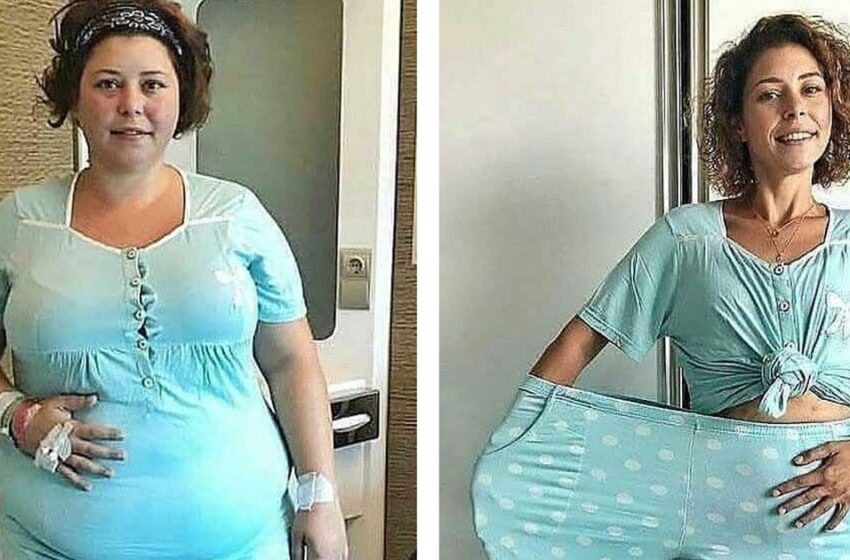 “Cuerpo Completamente Diferente con la Misma Ropa”: ¡7 Chicas Usando la Misma Ropa Antes y Después de Perder Peso!