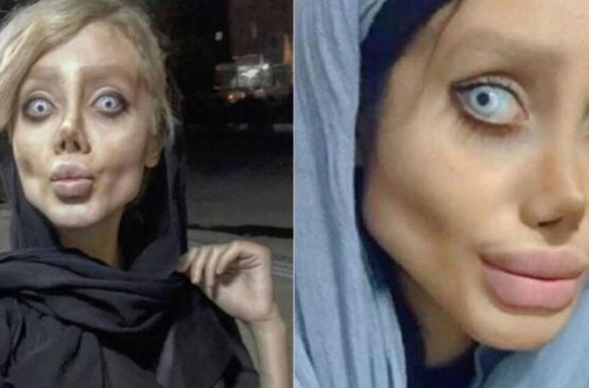“Es incluso aterrador mirarla”: ¡Se sometió a 50 cirugías y perdió 90 libras para parecerse a Angelina Jolie!