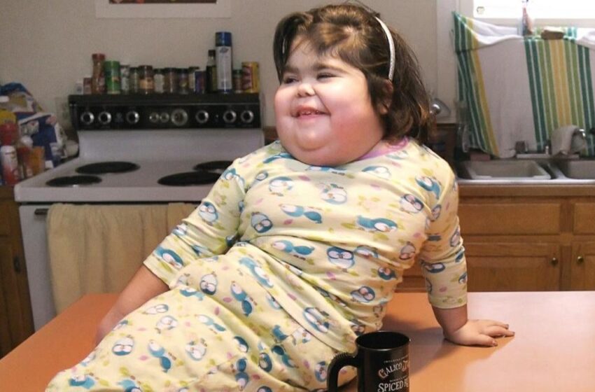 “Soy como todos los demás: un ser humano”: ¿Cómo se veía la niña nacida con el raro “síndrome de sirena”?