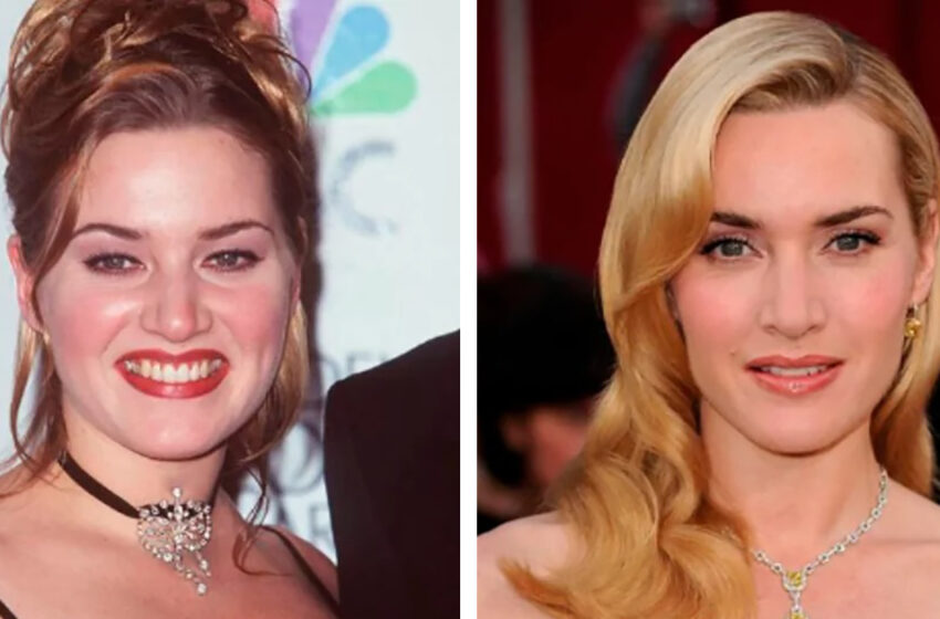“No reconocerás a muchos de ellos”: ¿Cómo lucían las estrellas de Hollywood antes de hacerse famosos?