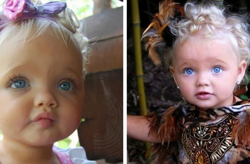 “Una niña nacida con una apariencia de muñeca”: ¿Cómo luce ahora?