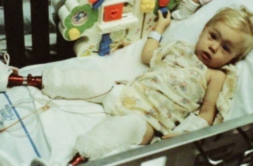  Una niña nacida con un defecto en la pierna fue abandonada en el hospital de maternidad por su madre: ¡creció y se convirtió en campeona!