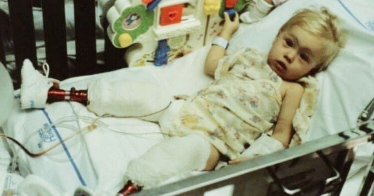 Una niña nacida con un defecto en la pierna fue abandonada en el hospital de maternidad por su madre: ¡creció y se convirtió en campeona!