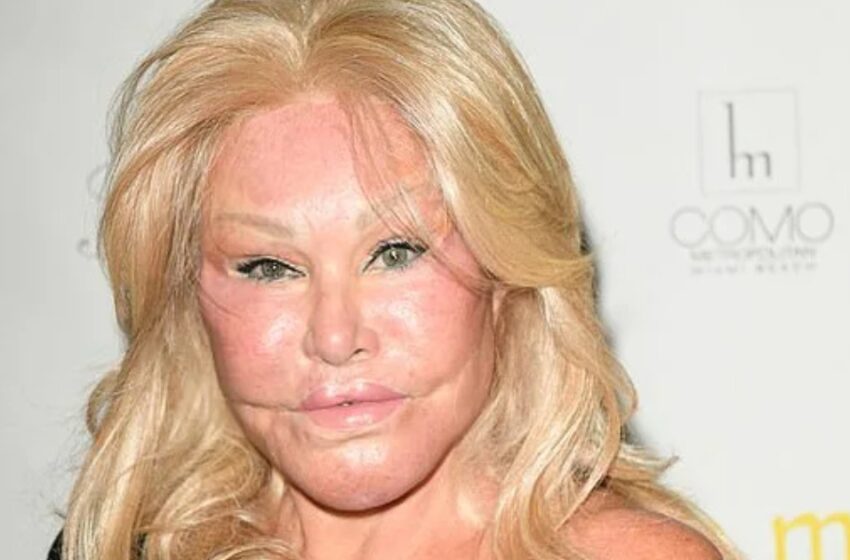 La “Mujer Gato”, obsesionada con la cirugía plástica a los 84 años, tiene un nuevo rostro y cuerpo: ¿Cómo luce ahora?