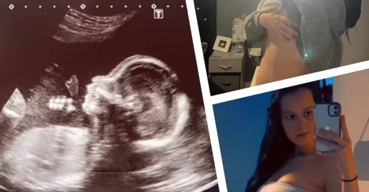 Una chica que estaba embarazada de 8 meses mostró su vientre, ¡pero nadie le creyó!