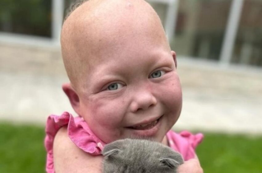 “Tengo 10 años, pero tengo el cuerpo de un niño de un año”: ¡La historia de la niña que sobrevivió a docenas de cirugías para sobrevivir!