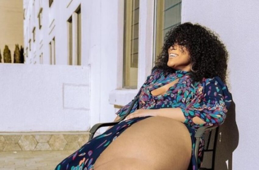 “Soy especial y eso es increíble”: Modelo con una apariencia única – una pierna de 45 kilogramos abraza su apariencia e inspira a otros a hacer lo mismo.