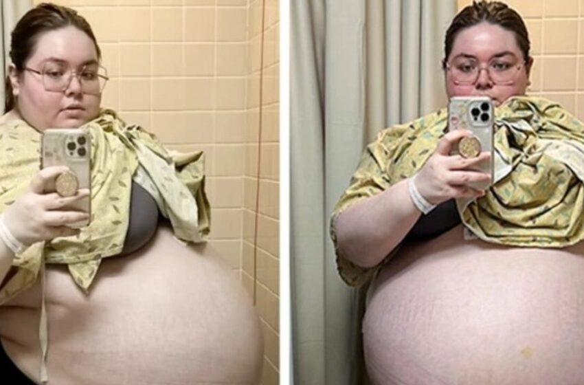 Los Médicos Le Aconsejaron Que Perdiera Peso: ¡Todos Quedaron Sorprendidos Cuando Se Descubrió Un Tumor de 104 Libras Dentro de Ella!