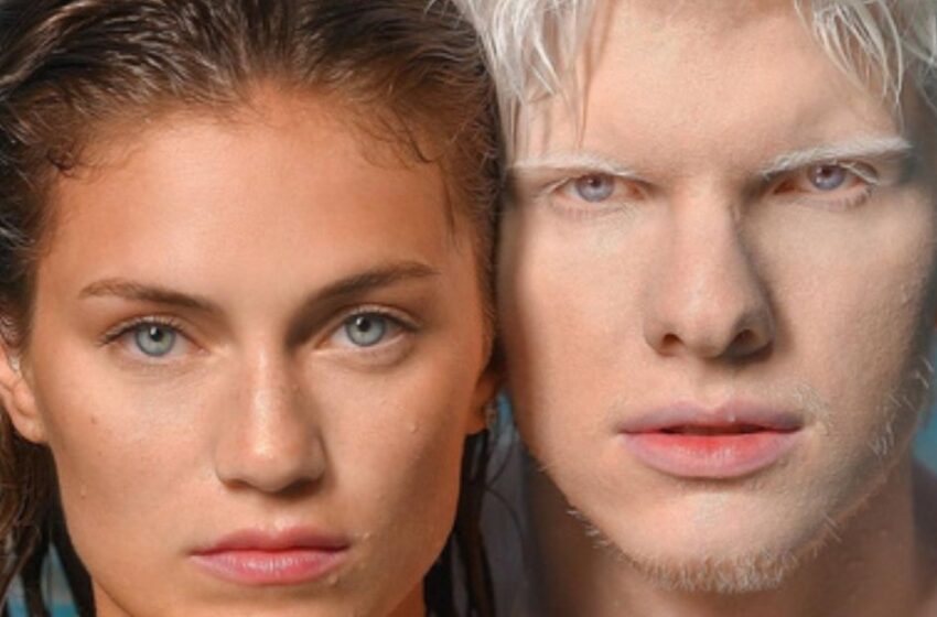 ¿Qué aspecto tiene el hijo del albino más hermoso y de la modelo georgiana?: “¡Un niño con una belleza especial!”