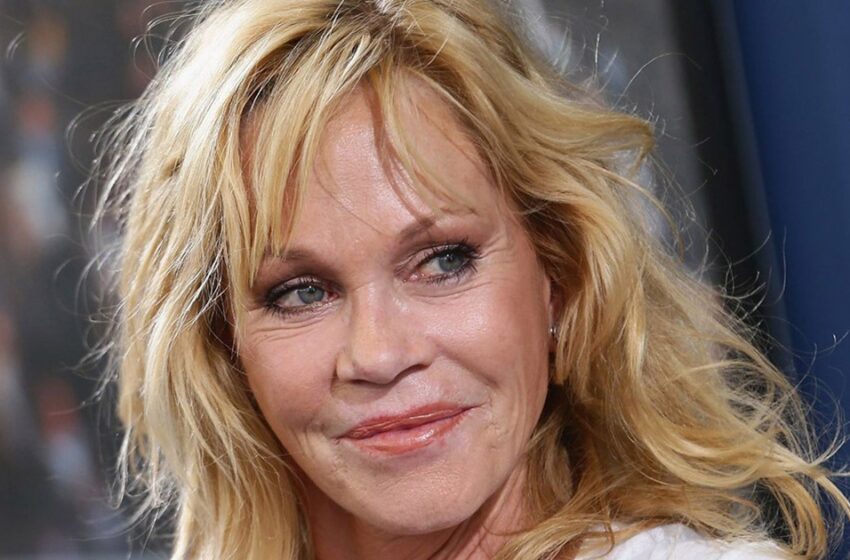  Cicatrices frescas y úlceras en el rostro: así luce hoy la encantadora actriz Melanie Griffith a sus 65 años.