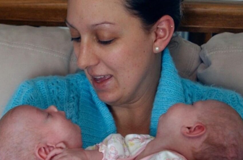 “Fueron operados a solo 6 meses de edad”: ¡La conmovedora historia de gemelos siameses que ahora están muy bien juntos!