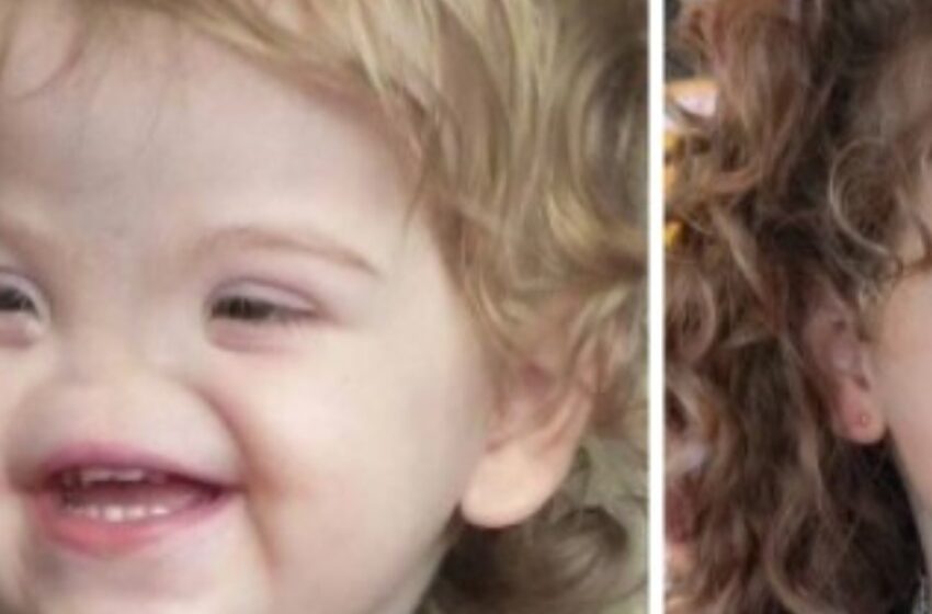 Conoce a una niña nacida sin nariz: Algunos la llaman “Voldemort”, ¡pero en realidad es una niña muy dulce!