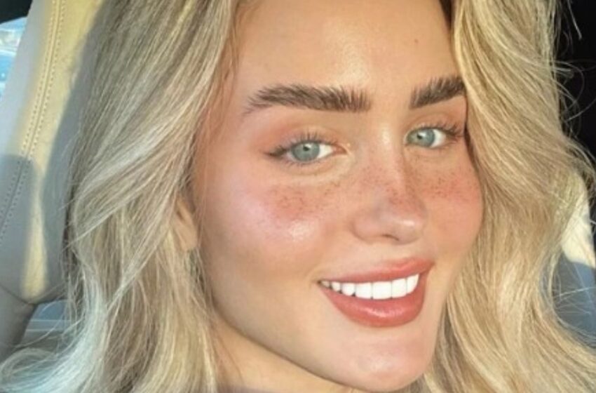 “¡Gasté $30,000 en una cirugía para cambiar mi rostro!”: ¡Así lucía la chica que se consideraba “fea” antes de la cirugía!