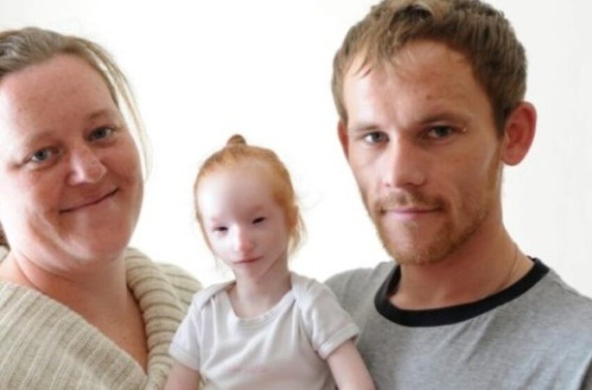 “Pesaba alrededor de 900 gramos”: ¡La niña más pequeña del mundo, Charlotte Garside, celebra su 16º cumpleaños!