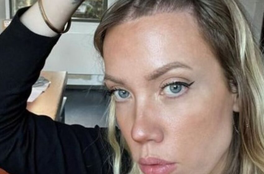 Una Chica con una ‘Frente Grande’ Se Realizó un Trasplante de Cabello y No Se Arrepiente: ¡Increíbles Fotos del Antes y Después!