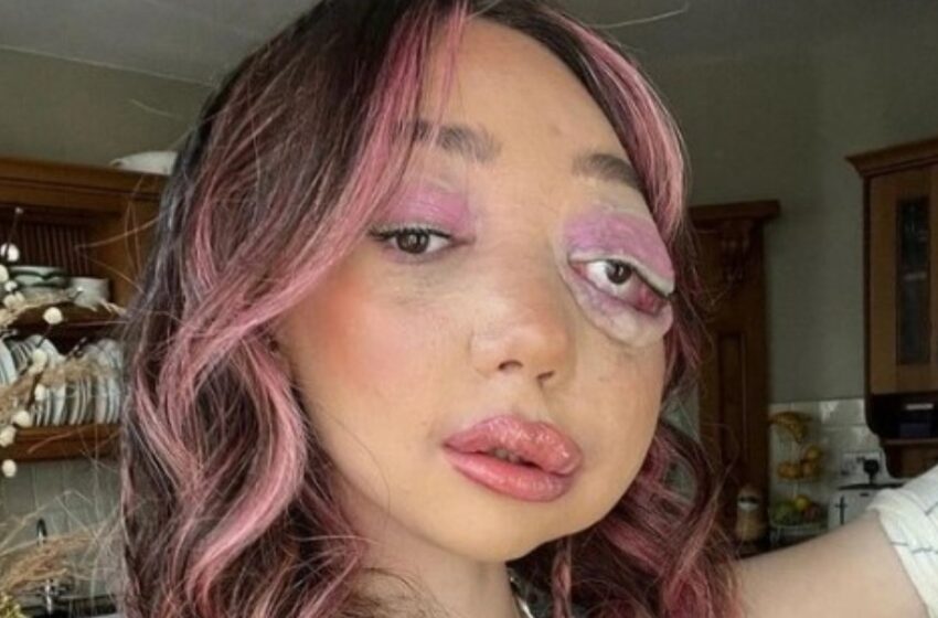 A pesar de una enfermedad rara que afectó su apariencia, esta joven se hizo popular y comparte secretos para una vida feliz con los demás