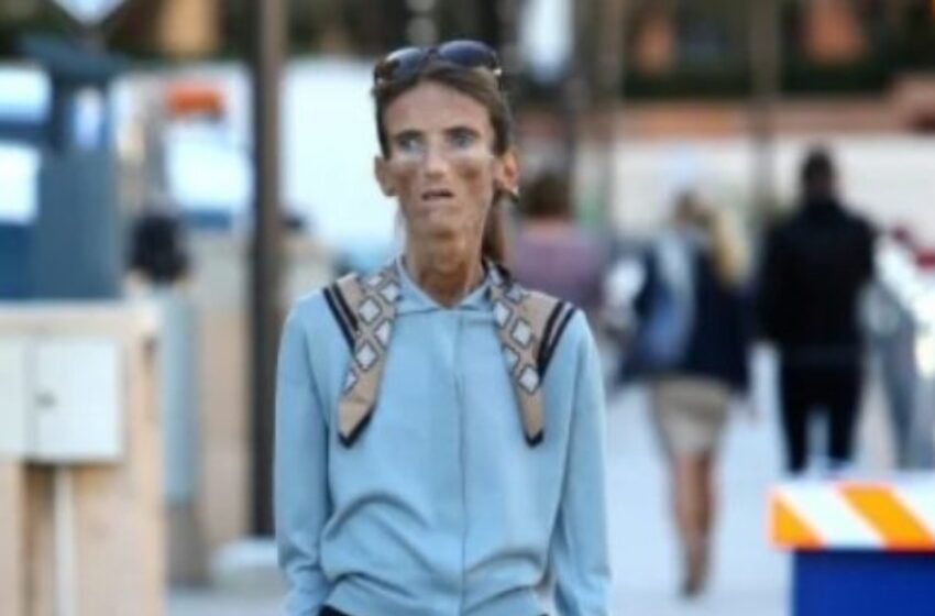 “Su madre siempre la apoyó en su deseo de perder peso”: La historia de una chica que perdió la batalla contra la anorexia