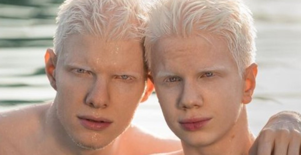 ¿Cómo Luce La Madre De Estos Hermanos Albinos?: “Familia Inusual”