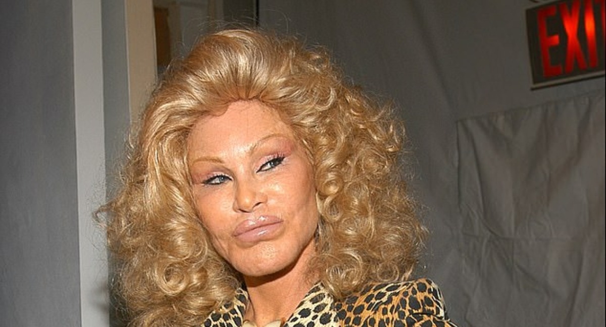 Pérdida Trágica: El prometido de Jocelyn Wildenstein revela detalles desgarradores sobre su repentina partida.