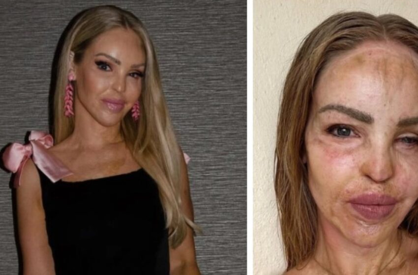  Katie Piper comparte una inspiradora actualización 16 años después de sobrevivir a un ataque con ácido: ¡Detalles inesperados!