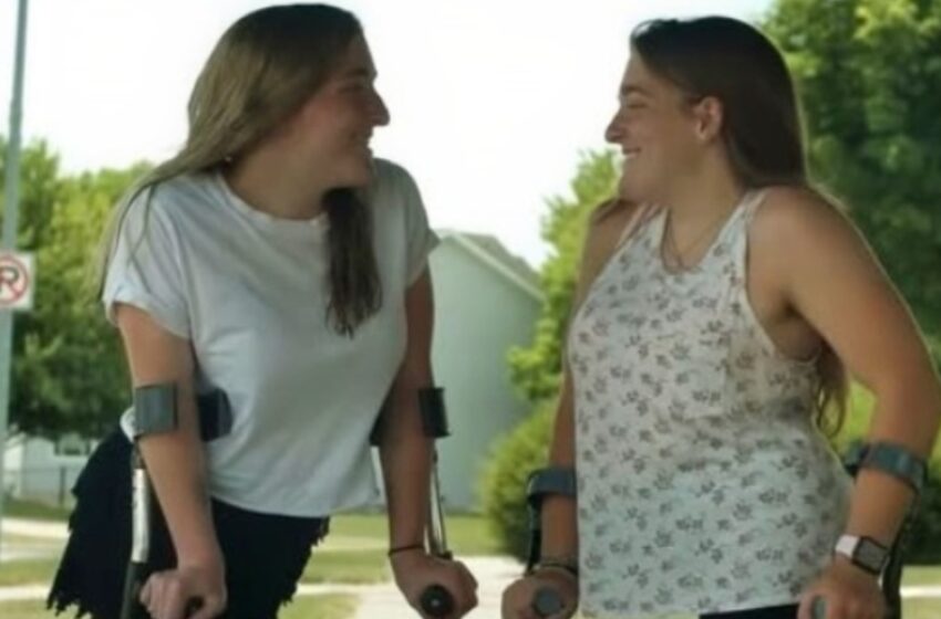 ¡Las ex siamesas ahora son adolescentes felices que llevan una vida normal!: ¡10 años después de su cirugía que les cambió la vida!