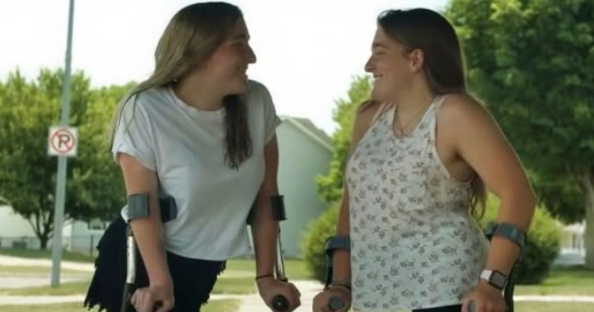 ¡Las ex siamesas ahora son adolescentes felices que llevan una vida normal!: ¡10 años después de su cirugía que les cambió la vida!