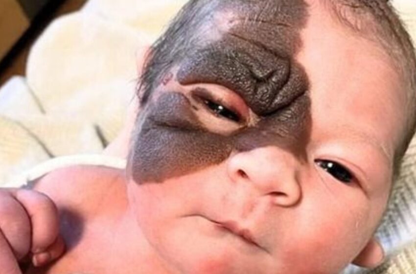Nacida con una marca única, la increíble transformación de esta valiente niña te derretirá el corazón: ¡mira sus fotos!