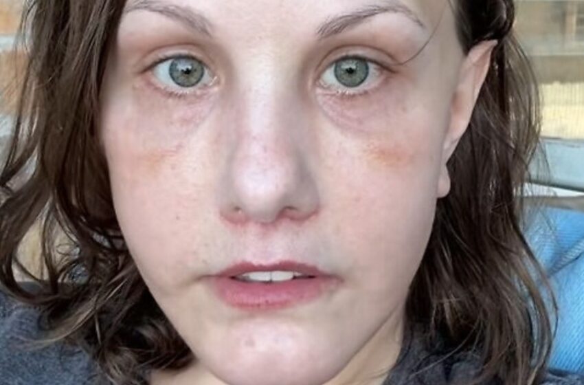  “Increíble cambio tras un lifting de \$15,000”: ¡La transformación de esta joven ha causado un caos en internet!