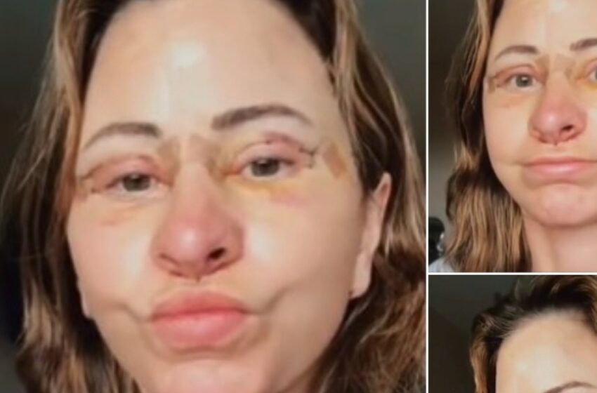 ¡Mujer gasta $14,000 en un lifting facial, vende su casa y adopta la vida en furgoneta tras una sorprendente transformación!