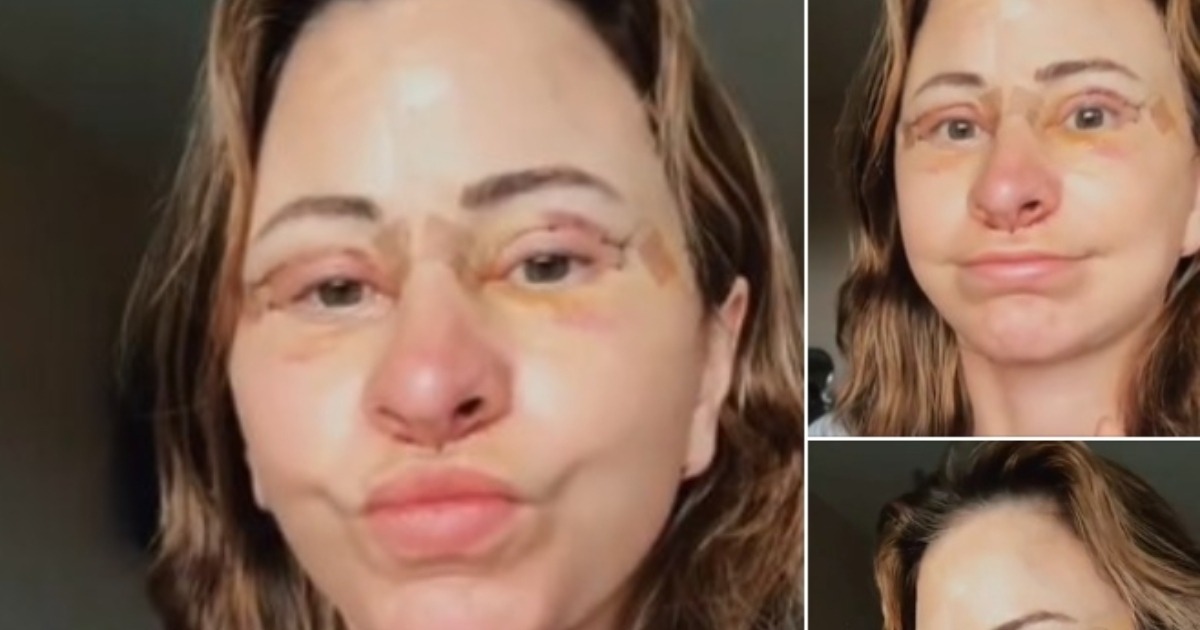 ¡Mujer gasta $14,000 en un lifting facial, vende su casa y adopta la vida en furgoneta tras una sorprendente transformación!