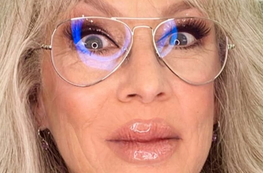  Leyenda de Hollywood Sorprende a los Fans con Labios Dramáticamente Sobrerellenos y un Nuevo Look Audaz.