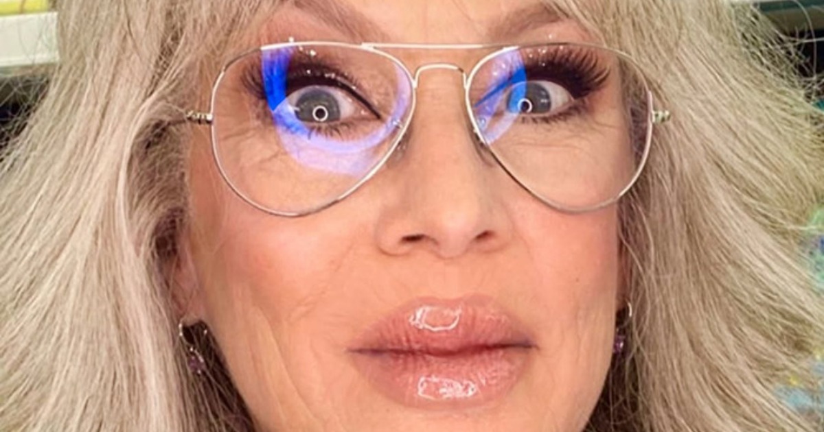 Leyenda de Hollywood Sorprende a los Fans con Labios Dramáticamente Sobrerellenos y un Nuevo Look Audaz.